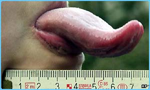 Image Image